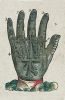 proteza dłoni autorstwa A. Pare